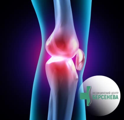 Knee joint arthrosis