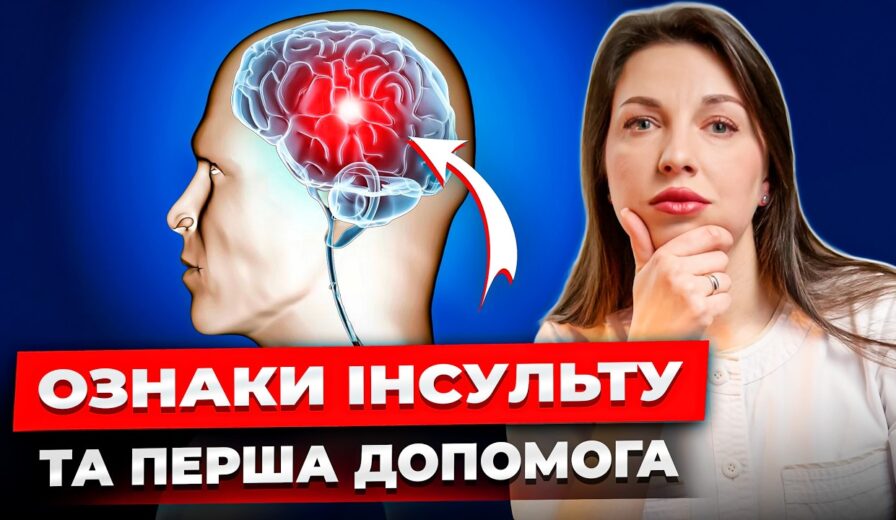 Як розпізнати інсульт? 5 перших ОЗНАК ІНСУЛЬТУ. Що робити до приїзду швидкої?